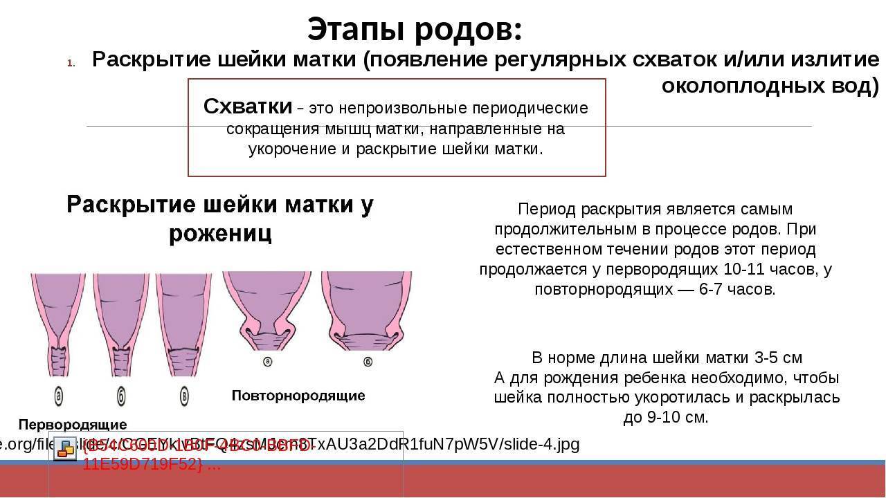 Как выглядит раскрытие шейки матки фото