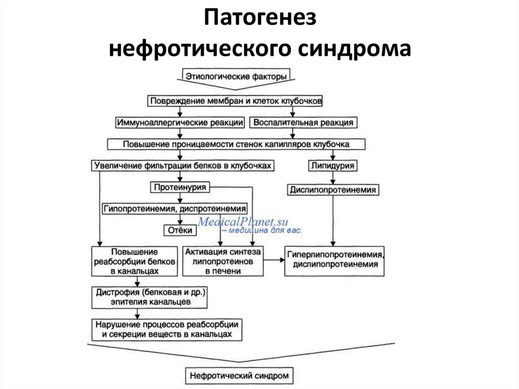 Патогенез синдрома. Нефритический синдром патогенез схема. Нефротический синдром патогенез. Схема патогенеза клинических проявлений нефротического синдрома. Механизм развития отеков при нефротическом синдроме.