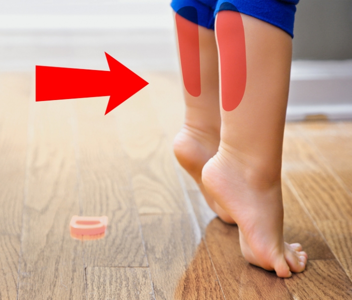 Ребенок ходит на носочках: причины в 2 года