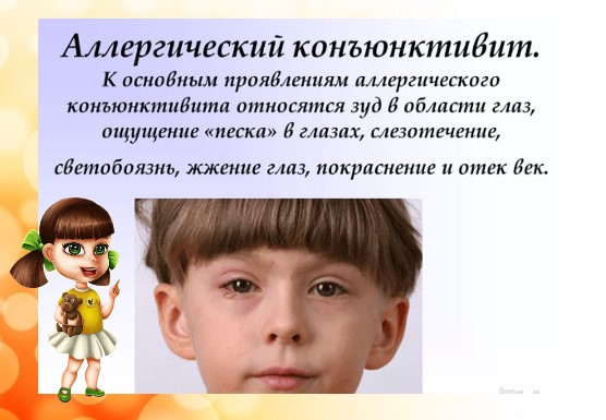 Возвращаем глазам нормальный вид: методы лечения конъюнктивита у детей и перечень препаратов