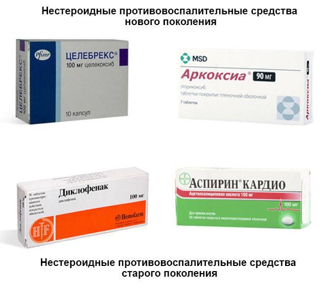 Нестероидные противовоспалительные препараты: список лекарств, зачем назначаются, при каких заболеваниях
