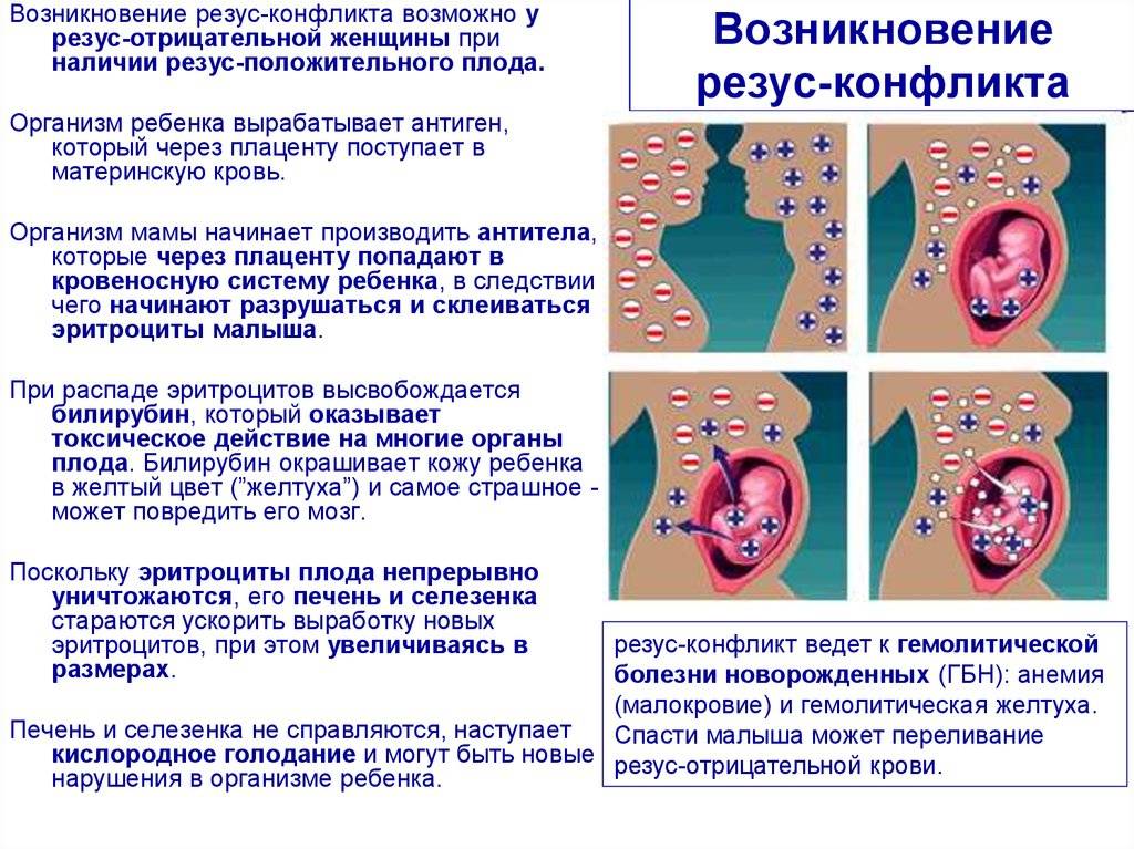 ✅ анализ на определение резус фактора плода по крови матери - денталюкс.su