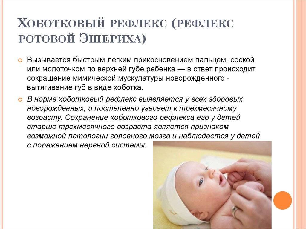 Рефлексы новорожденного: таблица, хватательный, сосательный, бабинского, бабкина, шаговый, робинсона
