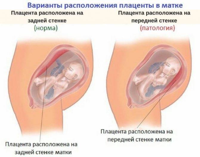Не по дням, а по часам. изменения матки во время беременности. размеры матки во время беременности