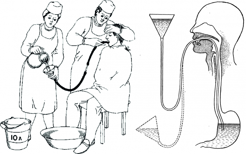 Промывание желудка презентация