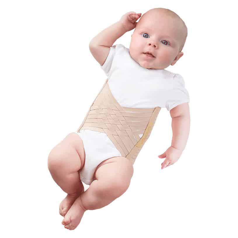 Бандаж для новорожденных: лечение пупочной грыжи