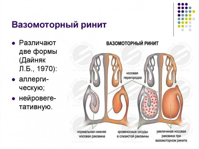 Аллергический ринит фото у детей