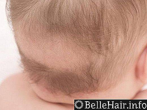 Волосы у новорожденных на голове