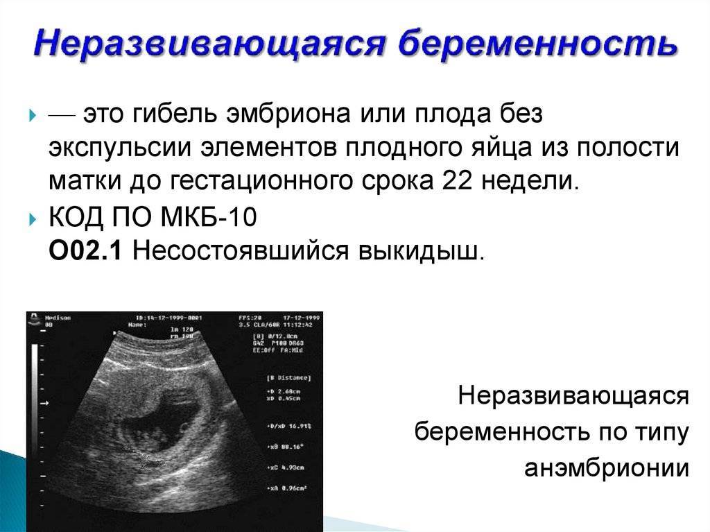 Причины замершей беременности - признаки на ранних сроках, после эко, лечение |
            эко-блог