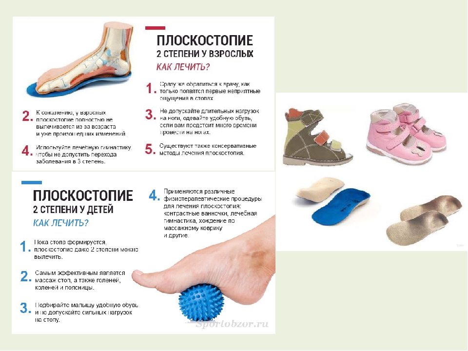 Плоскостопие у детей (50 фото): причины, виды, как лечить в домашних условиях, помогают ли ортопедические стельки, обувь