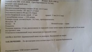 Тонус матки при беременности: симптомы, причины, лечение / mama66.ru