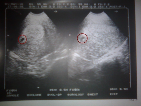 Узи в 2 недели беременности после зачатия: покажет ли, как выглядит плод (фото) и что видно, кому назначают, подготовка и проведение исследования
