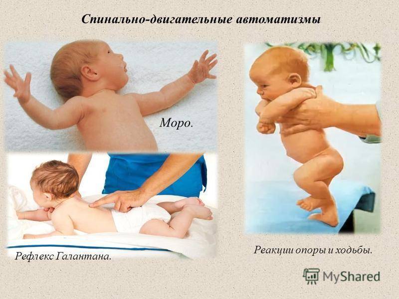 Рефлексы новорожденных — подробная таблица по месяцам