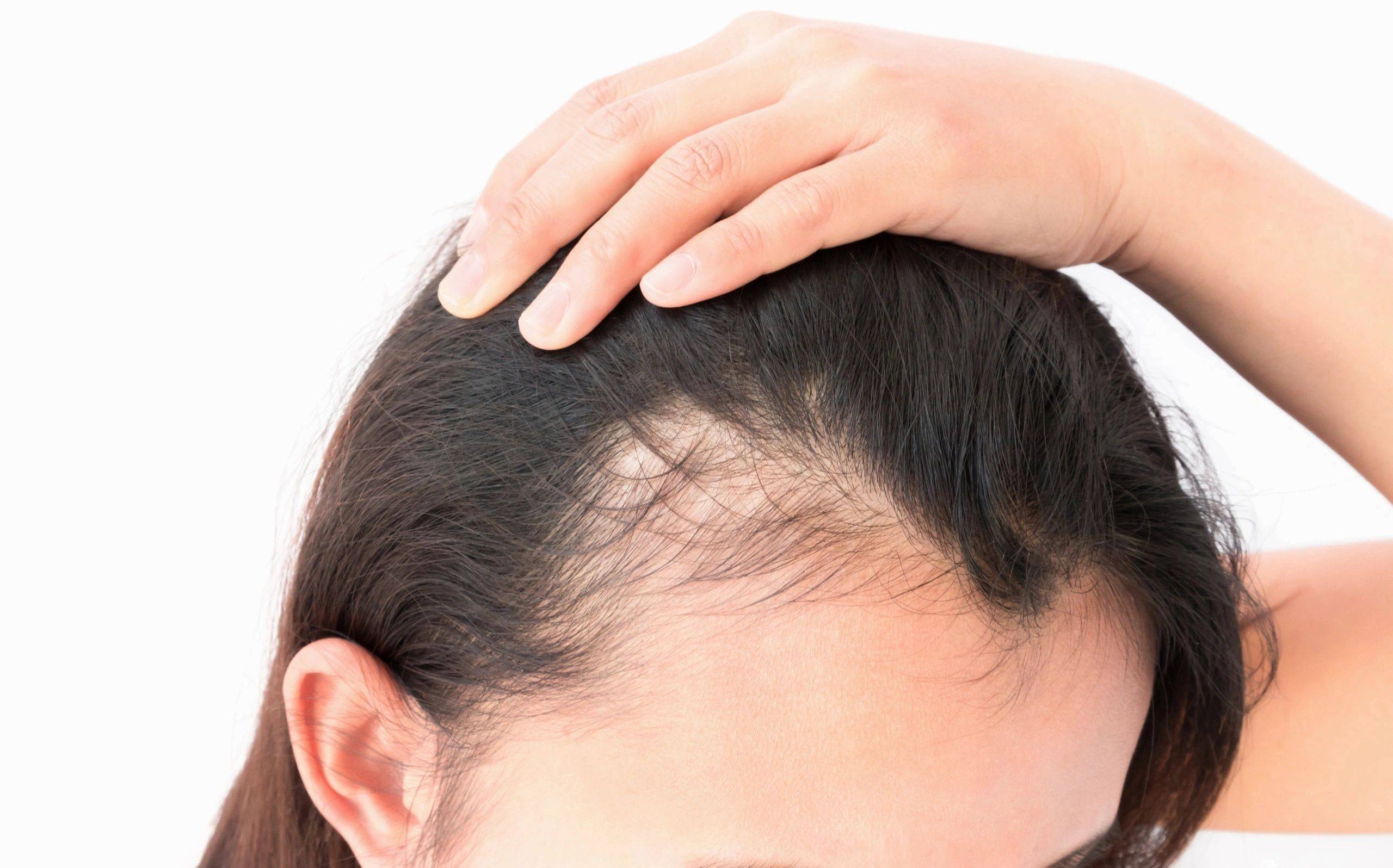 Выпадение волос у ребенка: что делать, причины потери, лечение, маски, какие витамины влияют, а также чем укрепить и как лечить сильно редеющую шевелюру