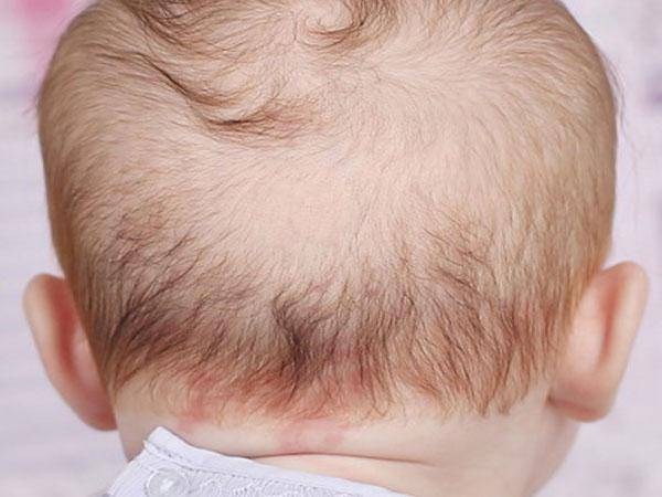 Почему у новорожденного ребенка плохо растут волосы?