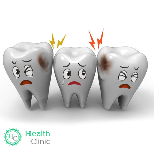 Кариес молочных зубов у детей – нужно ли лечить? статьи