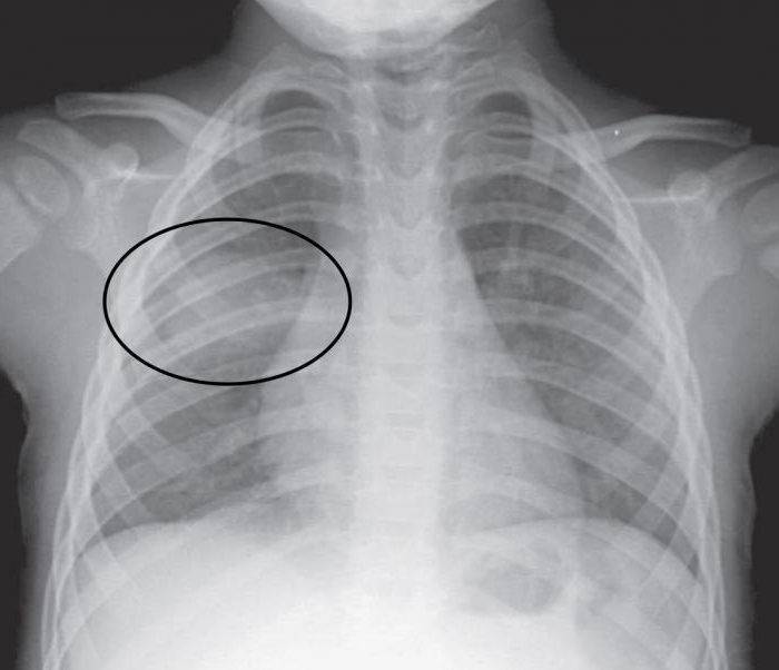 Опасность рентгена при беременности. рентген легких, зуба, носа на раннем и позднем сроке беременности. :: polismed.com