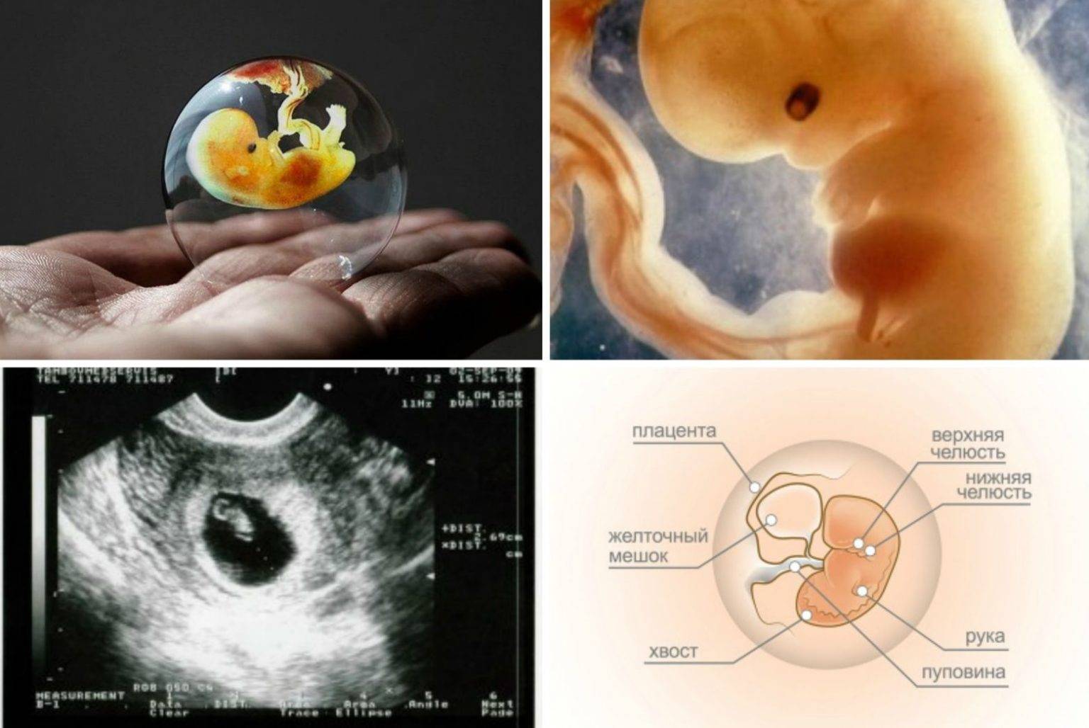 8 неделя беременности: что происходит с малышом и мамой, фото, развитие плода