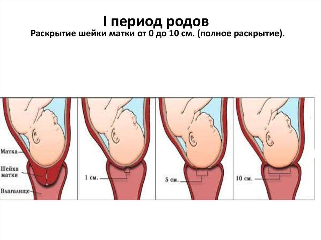 Как происходит проверка раскрытия шейки матки при родах, почему она раскрывается и что означают 1, 2 и более пальцев?