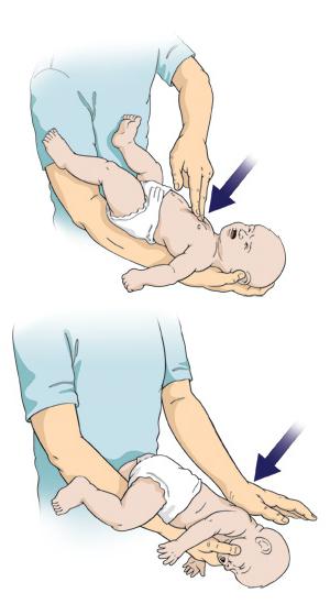 Что делать, если ребенок подавился и задыхается? - советы мамам | медицина - информационно-познавательный портал