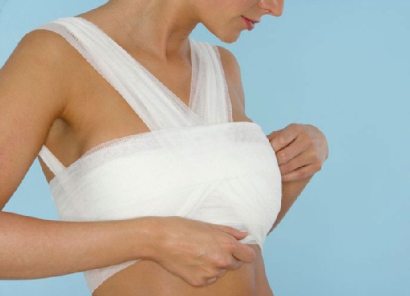 Как перетянуть грудное молоко. как перевязать грудные железы для предотвращения лактации