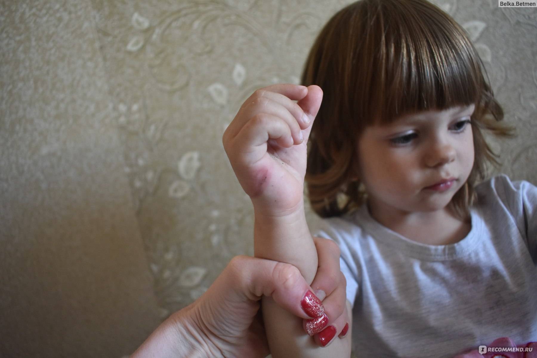 Как отучить ребенка сосать палец - причины вредной привычки