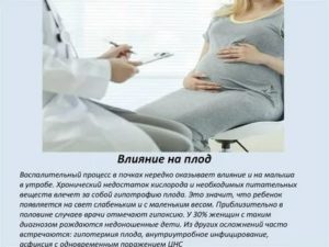 Симптомы и лечение фарингита при беременности, влияние на плод на 1 и 2 триместре