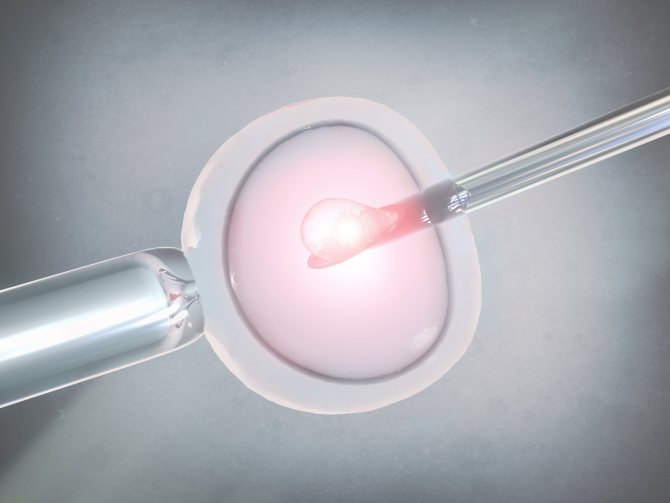 Подготовка к криопереносу эмбрионов, ход процедуры