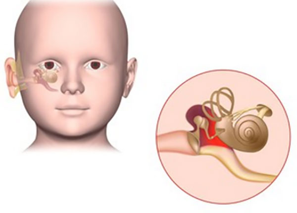Что делать, если у ребенка болят уши?