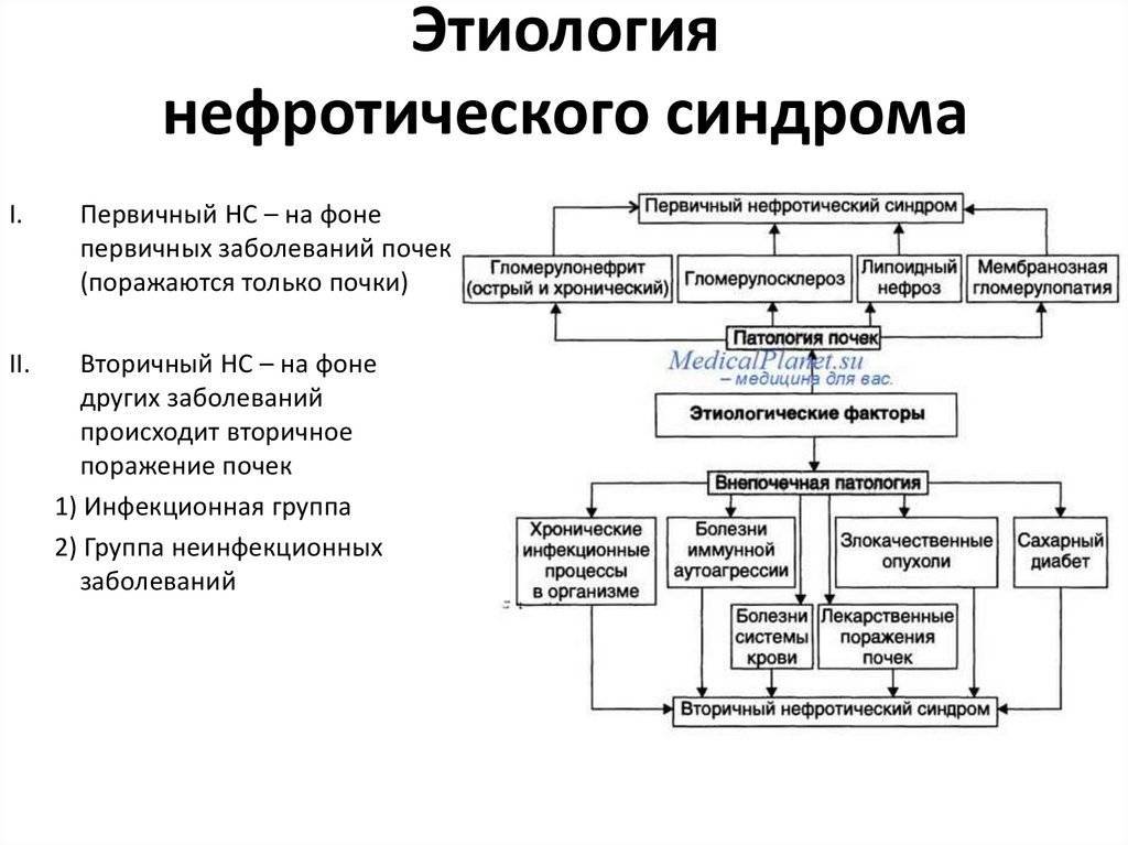 Нефротический синдром патогенез схема