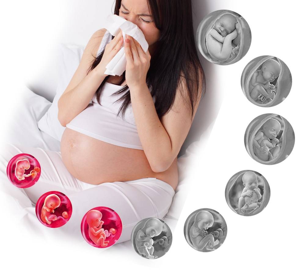 Замершая беременность: признаки и симптомы на раннем и позднем сроке