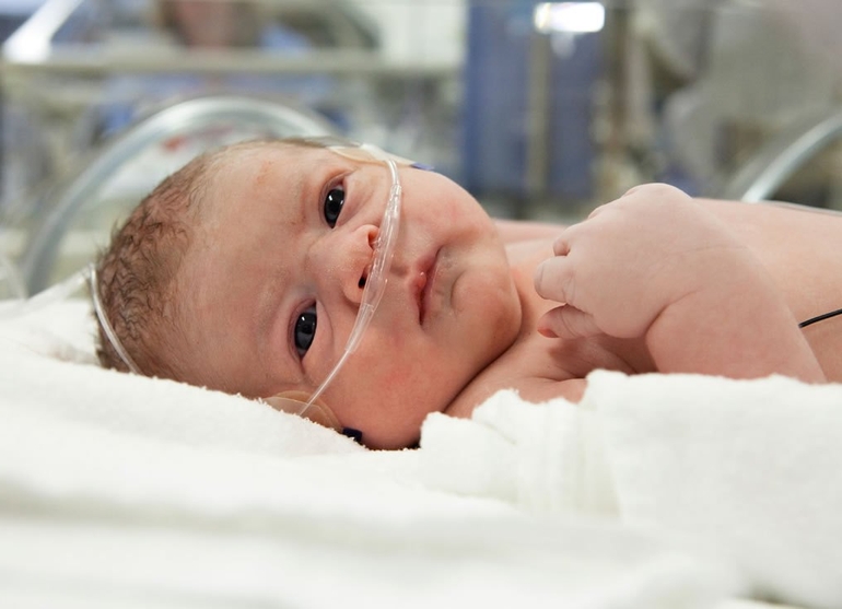 Гипоксически-ишемические поражения головного мозга у новорожденных
