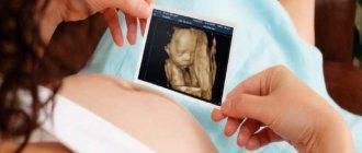 Расшифровка результатов узи при беременности, таблица – портал для мам, отзывы