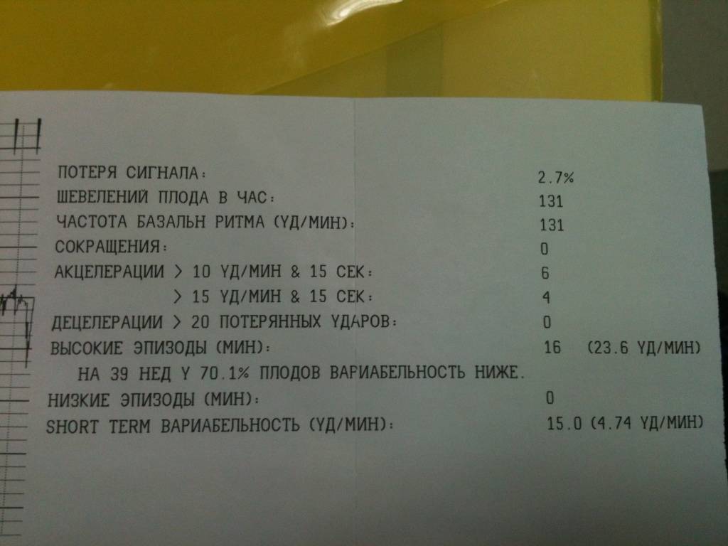 39 недель беременности данные. КТГ схватки показатели. КТГ при схватках показатели. Расшифровка КТГ при беременности при схватках. КТГ схватки расшифровка.