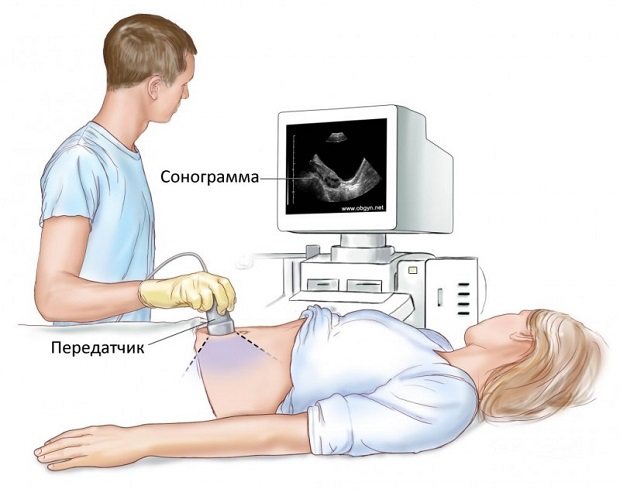 Подготовка к узи беременным