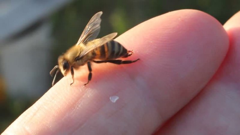 Укус пчелы: первая помощь в домашних условиях | lisa.ru