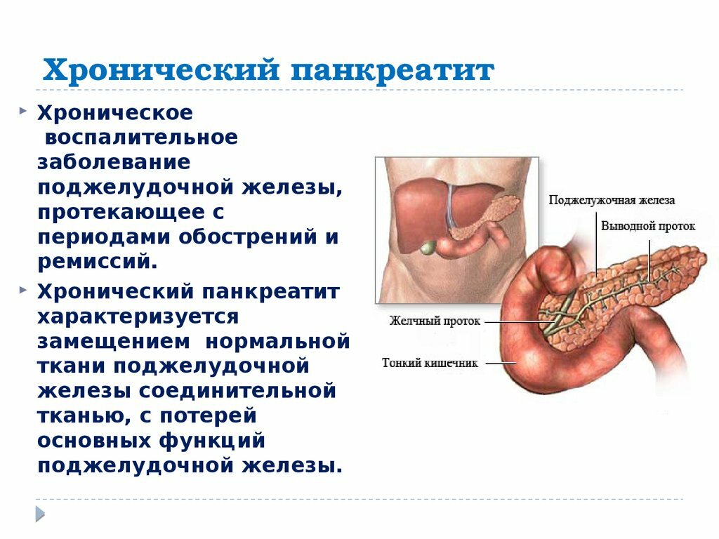 Острый панкреатит. причины, механизм развития, симптомы, современная диагностика, лечение, диета после острого панкреатита, осложнения болезни