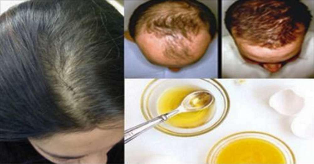 Если у ребёнка выпадают волосы: причины, диагностика и лечение
