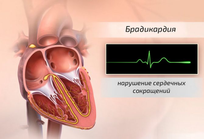 Синусовая брадикардия у детей | лечение сердца