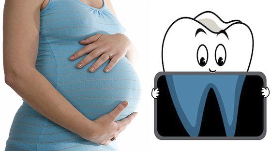 Рентген при беременности: как обезопасить будущего ребенка