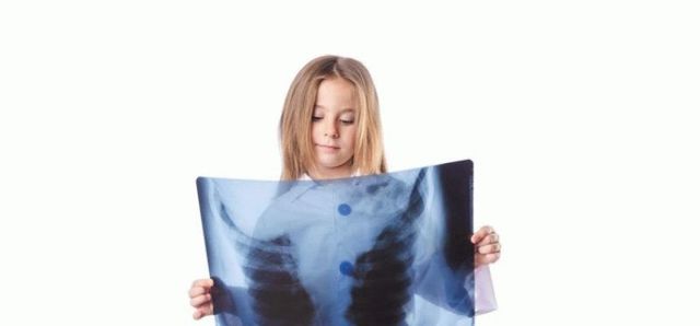 Как часто можно делать рентген ребенку и как это зависит от возраста