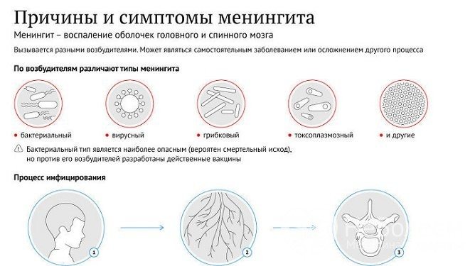 Инкубационный период и симптомы серозного менингита у детей