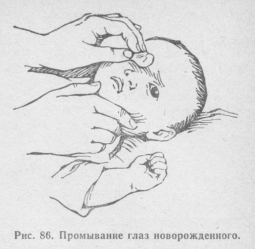 Чем промывать глаза новорожденному