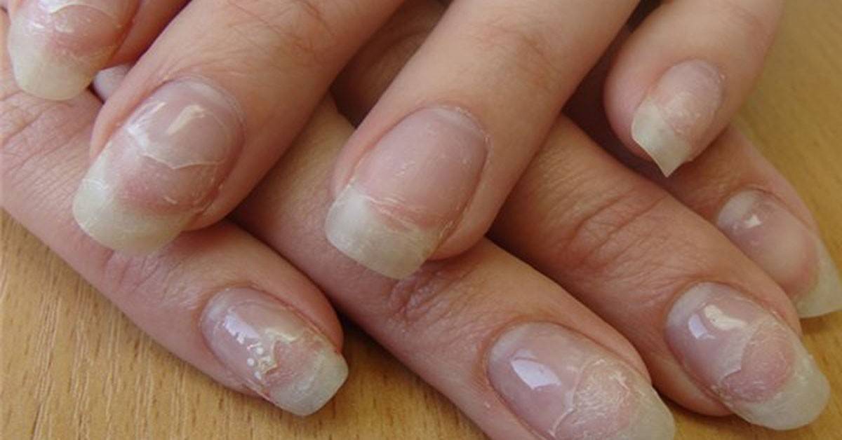 Можно ли наращивать ногти во время беременности?