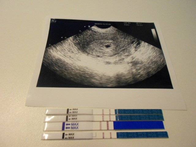Беременность 2 недели: фото узи, фото / 2 недели беременности: фото, видео