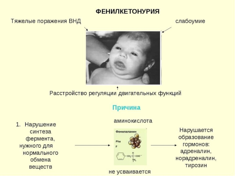 Фенилкетонурия (фку) у детей