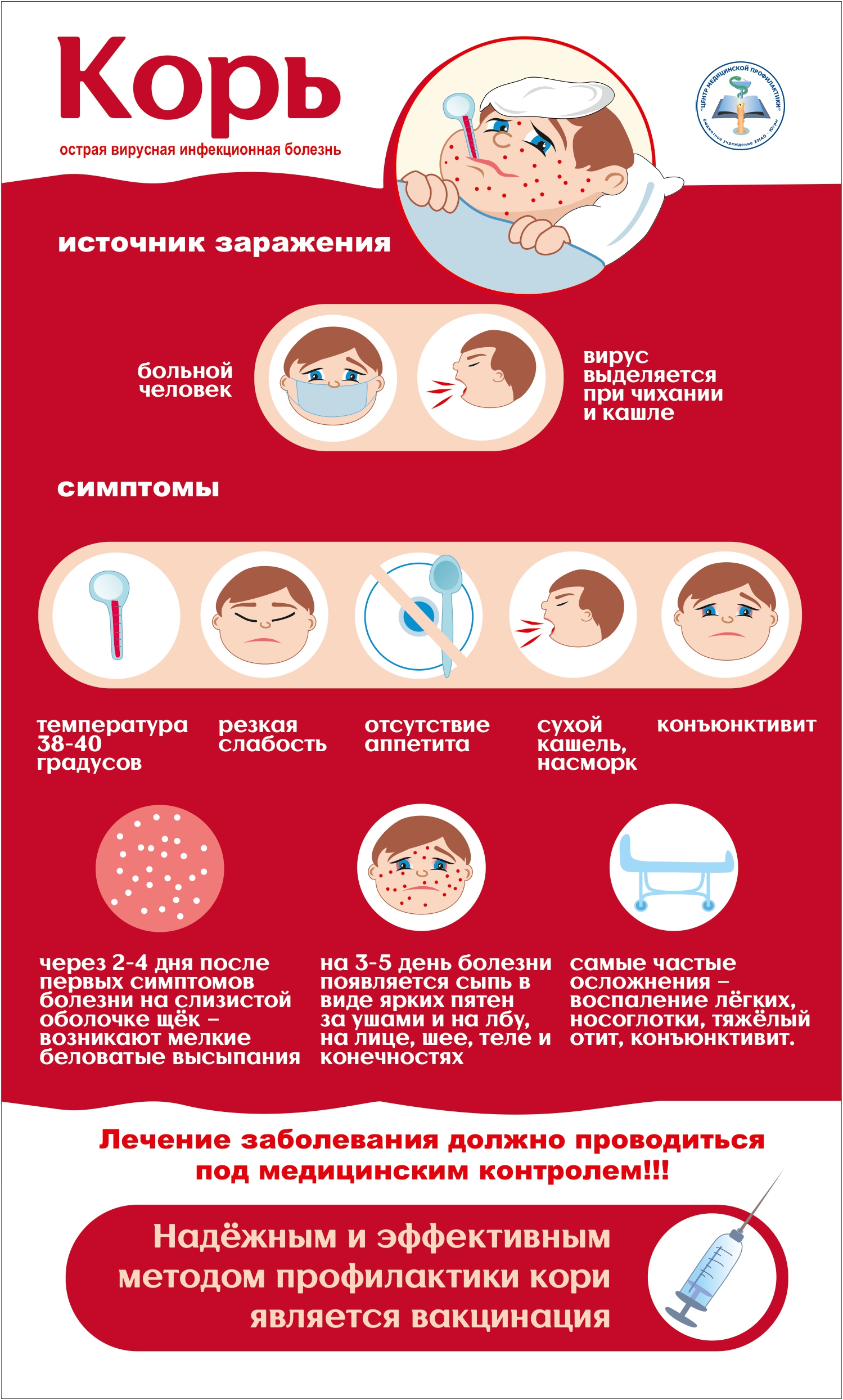 Корь у детей: первые признаки, симптомы и лечение