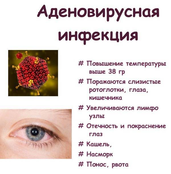 Аденовирусная инфекция (аденовирус): симптомы, лечение