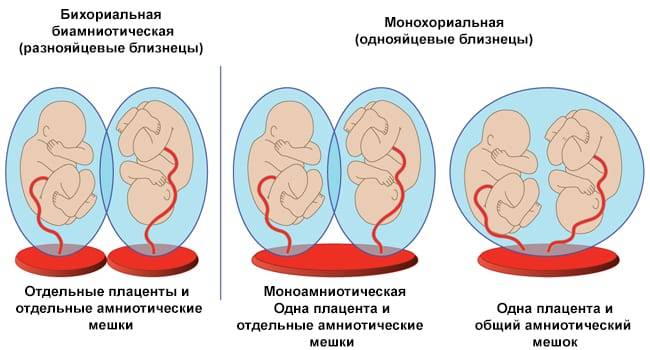 Факторы влияющие на вероятность зачатия двойни: питание и стресс