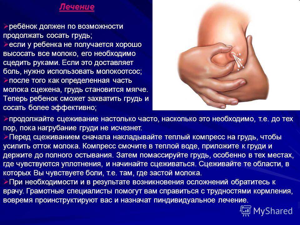 Лактостаз у кормящей матери симптомы и лечение: что делать и как лечить грудь / mama66.ru